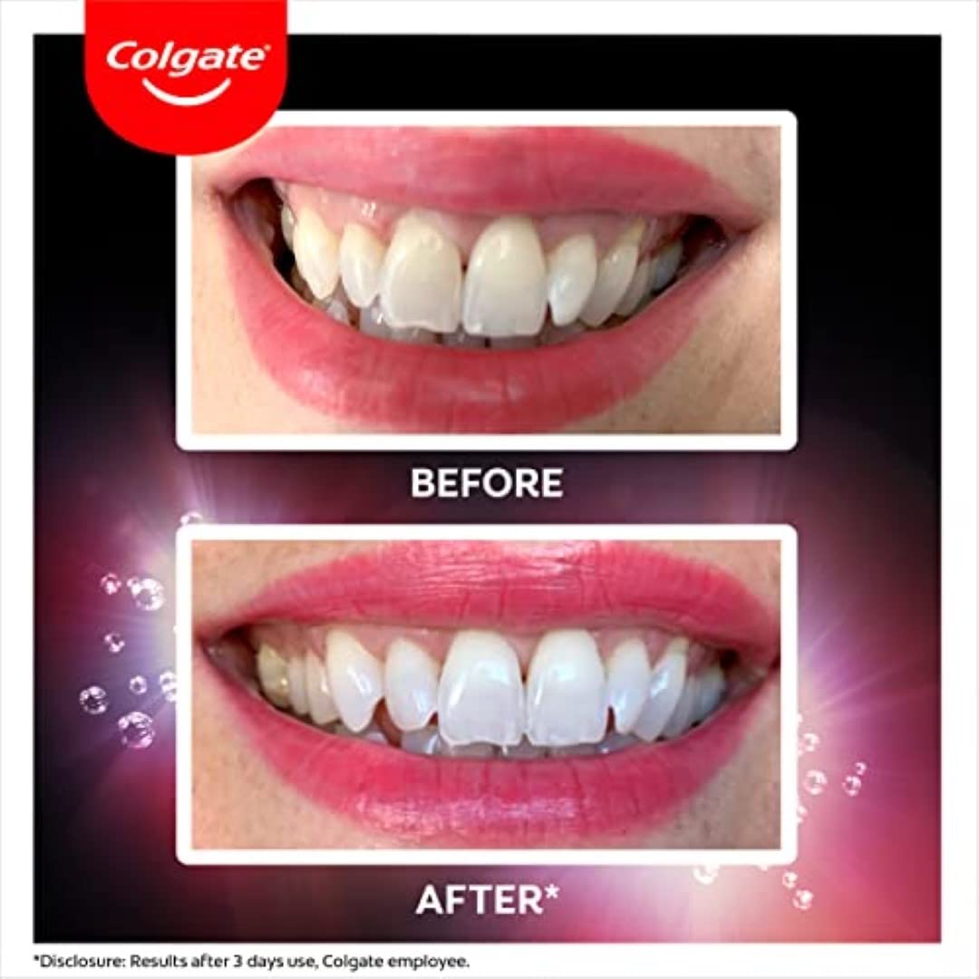 Colgate Max White Ultra Active Foam Toothpaste, At Home Whitening Toothpaste ...